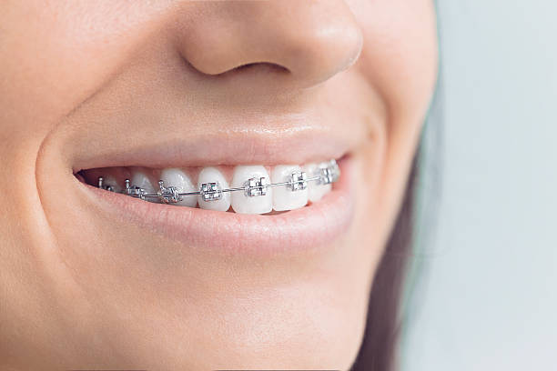 Trusted Rayville, LA  Holistic Dental Services Experts